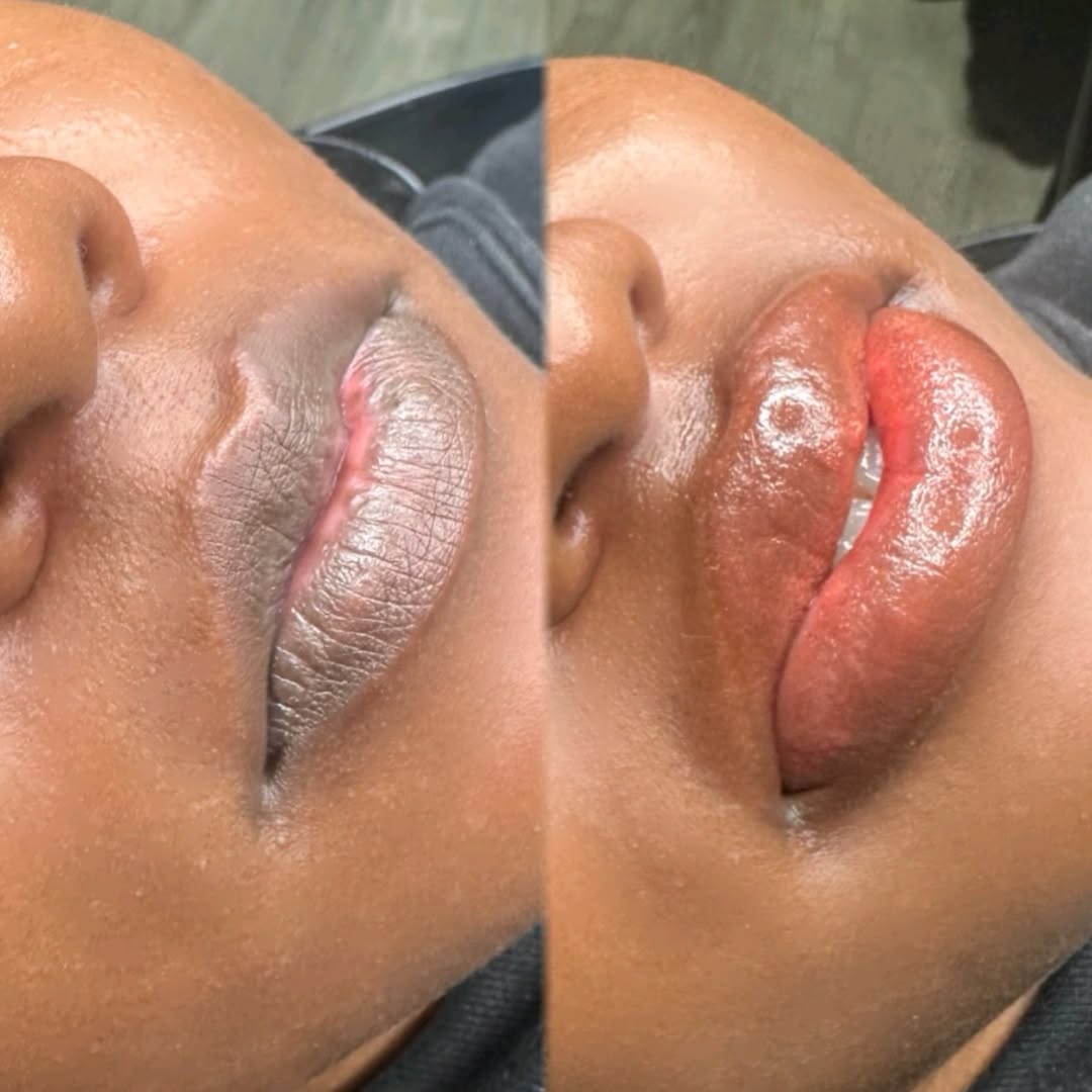 Lip blush treatment transformation